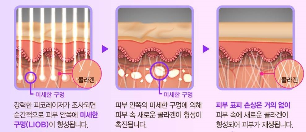 이미지명