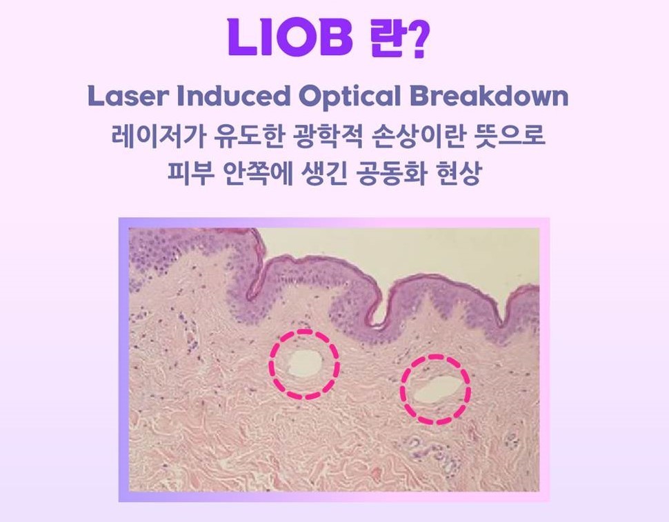 이미지명