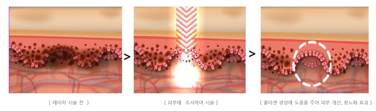 이미지명