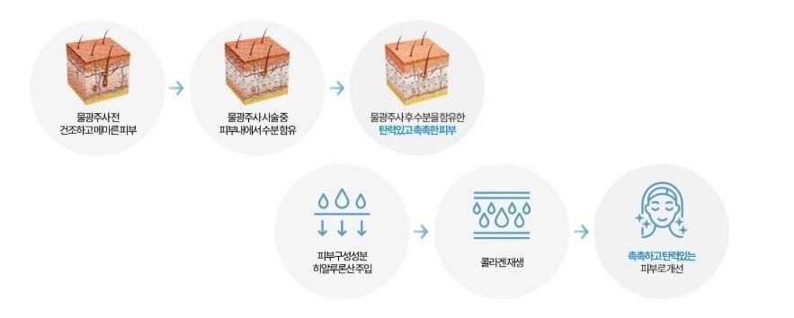 이미지명